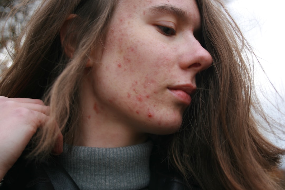 Adult acne skincare routine with simple products on a bathroom shelf